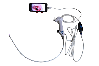 RNB DAP Series –- Premium Video Bronchoscope Set with USB Adapter (Laptop Compatible) RNB DAP Series –- Premium Video Bronchoscope Set with USB Adapter (Laptop Compatible)