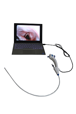 RNB Premium 5.2mm Laptop Compatible Video Bronchoscope without USB Adaptor (DAE3)
